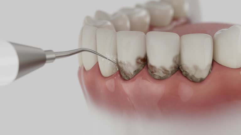 Reliable Dental Implants contractor in Delphi, IN by Smile Center Dentistry